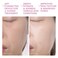 FOREOUFO 2 Red Light Therapy for Face  Anti Aging Face Moisturizer and Dark Spot Remover  for Deep Facial Hydration  Full LED Spectrum  Fuchsia