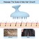 Silicone Scalp Massager Shampoo Brush Head Scrubber with Soft Bristles for Hair Growth Scalp Exfoliator for Dandruff Removal Wet Dry Hair Brush for Scalp Care Blue
