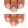 LONDONTOWNkur Nail Probiotic Instant Boost Nail Care Mask For WeakThin Nails Instant Hydration Boost Protective Care for Dry Damaged Nails