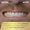 Waterpik SonicFusion 20 Professional Flossing Toothbrush Electric Toothbrush and Water Flosser Combo In One White SF04 Packaging May Vary