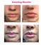 LifeCell Lip Plumping Treatment