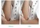 Epilator for Women Hair Removal Tools Epilator Rechargeable Sensor Light Epilator