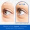 Eye Lash Enhancing Serum for Thicker Longer Looking Lashes  neuLASH Eyelash Serum by Skin Research Laboratories  Advanced Formula Improves the Look of Natural Lash Follicles  Healthy Lash Lines