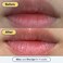 Remedy for Dry Lips  Hydrating and Healing Lip Balm Ointment with Ceramides Peptides and Dimethicone  Repairs Dry Cracked Lips  By Dermatologist Dr Shah