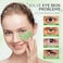 BREYLEE Aloe Vera Eye Masks60 Pcs  Puffy Eyes and Dark Circles Treatments Look Younger and Reduce Wrinkles and Fine Lines Undereye Improve and Firm eye Skin  Pure Natural Material Extraction