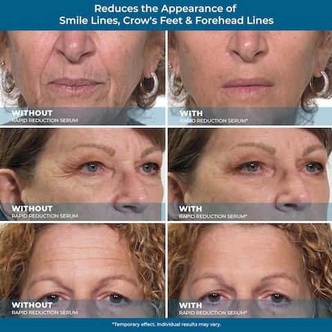 Plexaderm Rapid Reduction Eye Serum  Advanced Formula Anti Aging Visibly Reduces UnderEye Bags Wrinkles Dark Circles Fine Lines  Crows Feet Instantly Instant Wrinkle Remover for Face