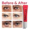 AntiAging Eye Cream for Wrinkles Under Eye Cream Treatment with Retinol  Collagen Reduces Fine Lines Dark Circles Eye Bags  Puffiness In 2 Weeks 085 fl oz