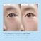 Under Eye Patches for Dark Circles Puffiness  Eye Bag Treatment Gel Mask with Caffeine Hyaluronic Acid Niacinamide  Undereye Brightening Hydrating AntiWrinkle  Cooling  Korean Skincare 30 Pairs