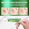 Advanced Keloid Bump Removal Gel Silicone Keloid Scar Removal Cream for Scars from Piercing Surgical Marks Acne and Burns Keloid Treatment for Ears Face and Body with Healing Formula 30g