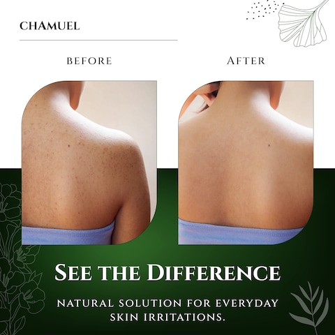 Chamuel Tea Tree Body Wash  Made With Natural Ingredients To Fights Itchy Skin Body Odor Athletes Foot Jock Itch  Toenails Issues  Organic Scented  Men  Women 118oz