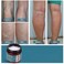 Varicose Vein Cream  Varicose Veins Cream for Legs Varicose  Spider Veins Soothing Leg Cream