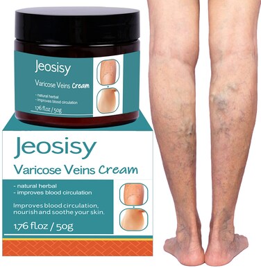 Varicose Vein Cream  Varicose Veins Cream for Legs Varicose  Spider Veins Soothing Leg Cream