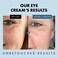 Under Eye Cream for Dark Circles and Puffiness  Eye Repair Cream Dark Circles Under Eye Treatment  Eye Cream Anti Aging Under Eye Serum Moisturizer Puffy Eyes Treatment Dark Circle