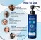 Folliculitis Seborrheic Dermatitis Psoriasis Shampoo Medicated AntiDandruff Treatment for Itchy Scalp Dermatitis AntiFungal Care for Men  Women Controls Oil Flaking  Scalp Irritation