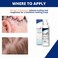 5 AntiDandruff Shampoo  Max Strength 5 Salicylic Acid Scalp BuildUp Clearing  Promotes Relief from Dandruff Psoriasis Seborrheic Dermatitis Dryness and Itchiness 177 milliliters