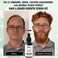 5 Minoxidil Hair and Beard Growth Serum  Natural Extracts Biotin  Caffeine  Promotes Stronger Thicker Fuller Hair and Beard Growth  For Men and Women
