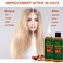 2 Pack Batana Oil Organic for Hair Growth Botana Oil Hair Growth Rosemary Oil Vitamin E Blend Massager Boosting Hair Thickness Nourish Scalp Hair 676 floz