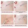Blackhead Remover 2 PCS Pimple Popper Stainless Steel Pimple Extractor Blackhead Removal Tool Risk Free Treatment for BlemishWhitehead Popping