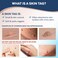 Advanced Skin Tag Remover  FDACleared Device  Only for Skin Tag Removal  Works in 714 Days  Up to 10 Treatment Cycles  Cryogenic FreezeOff Kit