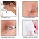 Pointed Blackhead Removal 2in1 Acne Extractor Tool  Stainless Steel Whitehead Remover for FaceNose