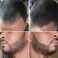 Beard Pen Filler for Men  Barber Styling Grooming Pencil  Waterproof Proof Sweat Proof Long Lasting Solution with Natural Finish  Cover Beard and Scalp Patches in Seconds  Black 1 Pack