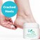 Banish My Callus Foot Callus Cream Hand Callus Remover  For Softening Rough Hard Dry Skin on Feet Hands Knees Elbows