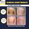 NONYX Fungal Nail Clarifying Gel  Rids Nails of Fungus by Removing Keratin Debris Where Nail Fungus Grows  90 of Toenails Improved Using this Toenail Fungus Treatment  4 oz