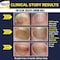 NONYX Fungal Nail Clarifying Gel  Rids Nails of Fungus by Removing Keratin Debris Where Nail Fungus Grows  90 of Toenails Improved Using this Toenail Fungus Treatment  4 oz
