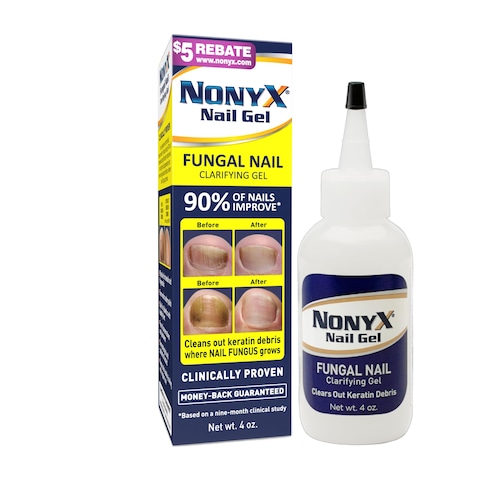 NONYX Fungal Nail Clarifying Gel  Rids Nails of Fungus by Removing Keratin Debris Where Nail Fungus Grows  90 of Toenails Improved Using this Toenail Fungus Treatment  4 oz