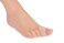 Silipos Gel Toe Spreader for Relieving Pain Due to Bunions Overlapping Toes Toe Drift and Calluses Item 11505 Size Small 4 per Polybag