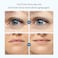 OIA Anti Wrinkle Patches 20 Eyes  Smile  Smile Lines  Eyes Wrinkles  Made with 100 Medical Grade Silicon  Advanced Wrinkle Care with Clear Reusable Pads  Overnight Wrinkle Smoothing