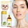 Nigrifix Green Tangerine Vita C Dark Spot SerumVitamin C Face Serumfor Face Serum with Hyaluronic Acid  Vitamin EAnti Aging Anti Wrinkle Skin 101 fl oz
