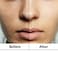 Dark Spot Serum  Targets Scars Marks and Evens Skin Tone  Blemish and Breakout Care