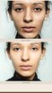 Dark Spot Serum  Targets Scars Marks and Evens Skin Tone  Blemish and Breakout Care