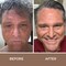 Vitiligo Vanquish Cosmetic Camouflage Kit by Fake Bake Liquid Concealer Long Lasting Natural Color Customization Eliminates Appearance of Skin Depigmentation For Women  Men  Cover Lasts For Days