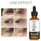 Dark Circles Under Eye Treatment for Women Caffeine Serum Circles Puffiness Bags Anti Aging Reduces Wrinkles and Fine Line 100 Pure Coffee Oil  1 oz  30 ml 1 Fl Oz Pack of 1