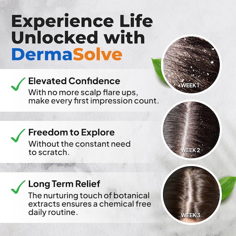 Dermasolve4 oz Psoriasis Seborrheic Dermatitis  Dandruff Scalp Oil  Dermatologist Approved  Itchy Flaky Scalp Relief  Clinically Tested LongLasting ItchFree HighPerformance Formula