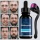 Minoxidil Beard Growth Oil 5 Minoxidil Hair Growth Kit 5 Minoxidil for Men Beard Growth Spray Infused with Bitoin Extra Strength Beard Growth Serum to Increase Thickness and Volume Faster