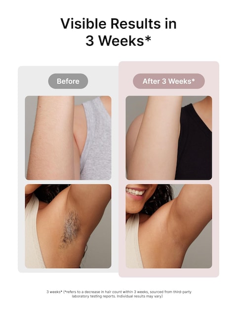 UlikeLaser Hair Removal for Women and Men Air 3 IceCooling IPL Device Hair Removal for Nearly Painless  LongLasting Results 3 Modes  Auto Flashing for Fast Full Body Hair Removal from Home