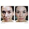 StaTight Anti Aging Serum To Reduce Fine Lines Around Eyes Mouth  Forehead Smoothing Skin Care For Wrinkles Lifting  Firming Serums For Skin Care 05 Fl Oz by Biologic Solutions