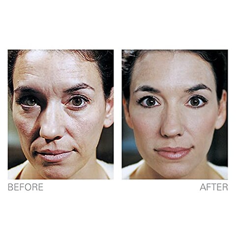 StaTight Anti Aging Serum To Reduce Fine Lines Around Eyes Mouth  Forehead Smoothing Skin Care For Wrinkles Lifting  Firming Serums For Skin Care 05 Fl Oz by Biologic Solutions