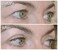 Eye Magic Original Eye Lift Kit SmallMedium Size With Gel Lifts Eyelid Droop and Hooded Eyes  Open And Show Off Your Beautiful Eyes  Made In America