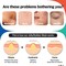 VILVIN Collagen Modeling Mask Korean  Peel off Jelly Mask Powder Pack for Soothing and Pore Management  4 cup pack set