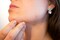 Quick Clear Blemish Control Acne Spot Treatment Drying Lotion Face Back Chest Zit Pimple Treatment Cold Sore Remedy Men Women Teens