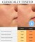 Pore Refining Serum  Niacinimide Free  Yellowmello Extract 92 with Salicylic acid 1 floz  Pore Minimizing serum for Face  Korean Skincare Serum for Face  Nose pore minimizer