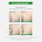 WELLAGE CICA Calming Pore Tightening Exfoliating Toner Pads 70 Pads  with Centella Asiatica PHA LHA and Madecassoside Facial Pads for Moisturizing and Soothing