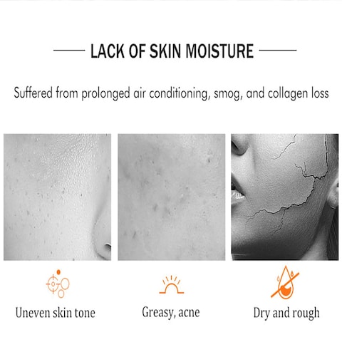 AICHUN BEAUTY Essence Facial Mask Tencel Material Antiacne Antiwrinkles After Sun Moisturizing Deep Cleaning Contractive Pore 25ml088floz X 10pcs VITAMIN C  NICOTINAMIDE10pcs