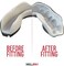 SafeJawz Sports Mouthguard Dual Layer Premium Protection Adults and Junior Gum Shield with Case for Boxing MMA Rugby Martial Arts Judo and All Contact Sports