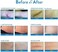 Aroamas Scar Professional Soft Silicone Scar Sheets Strips Soften and Flattens Scars Resulting from Surgery Injury Burns CSection and More 3x157 8 Sheets for 4 Month Supply