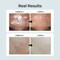 numbuzin No1 PureFull Calming Herb Toner  Breakouts Redness Excess Oil Control Blackhead Removal  Centella Asiatica Heartleaf Licorice Root  AcneProne Sensitive Skin  1014 fl oz
